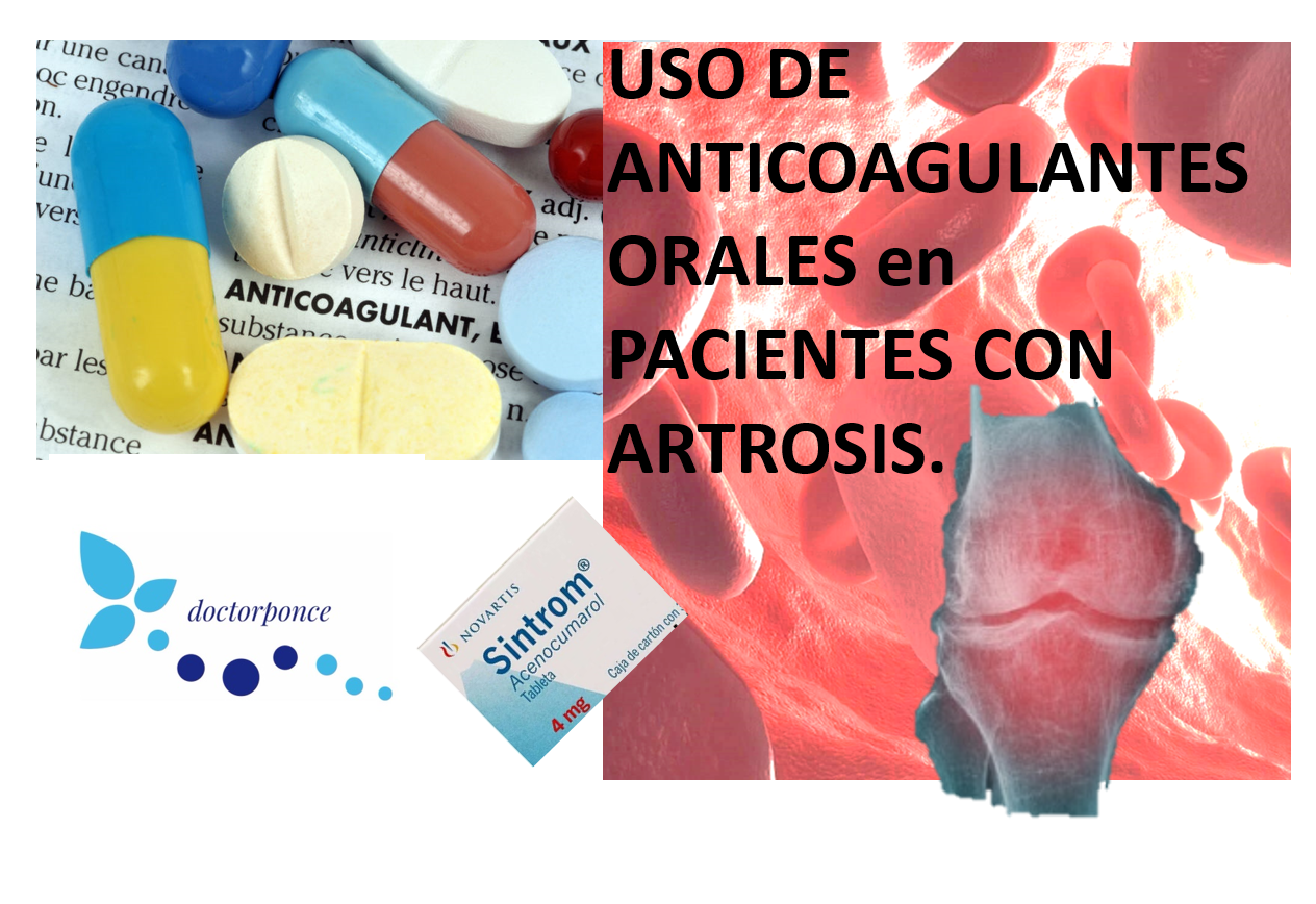 Uso de anticoagulantes en pacientes con artrosis