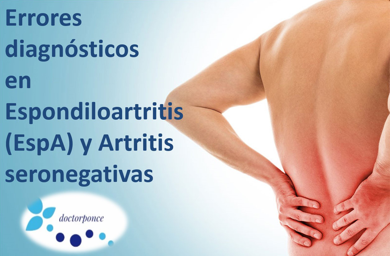 Errores diagnósticos en espondiloartritis y artritis seronegativas